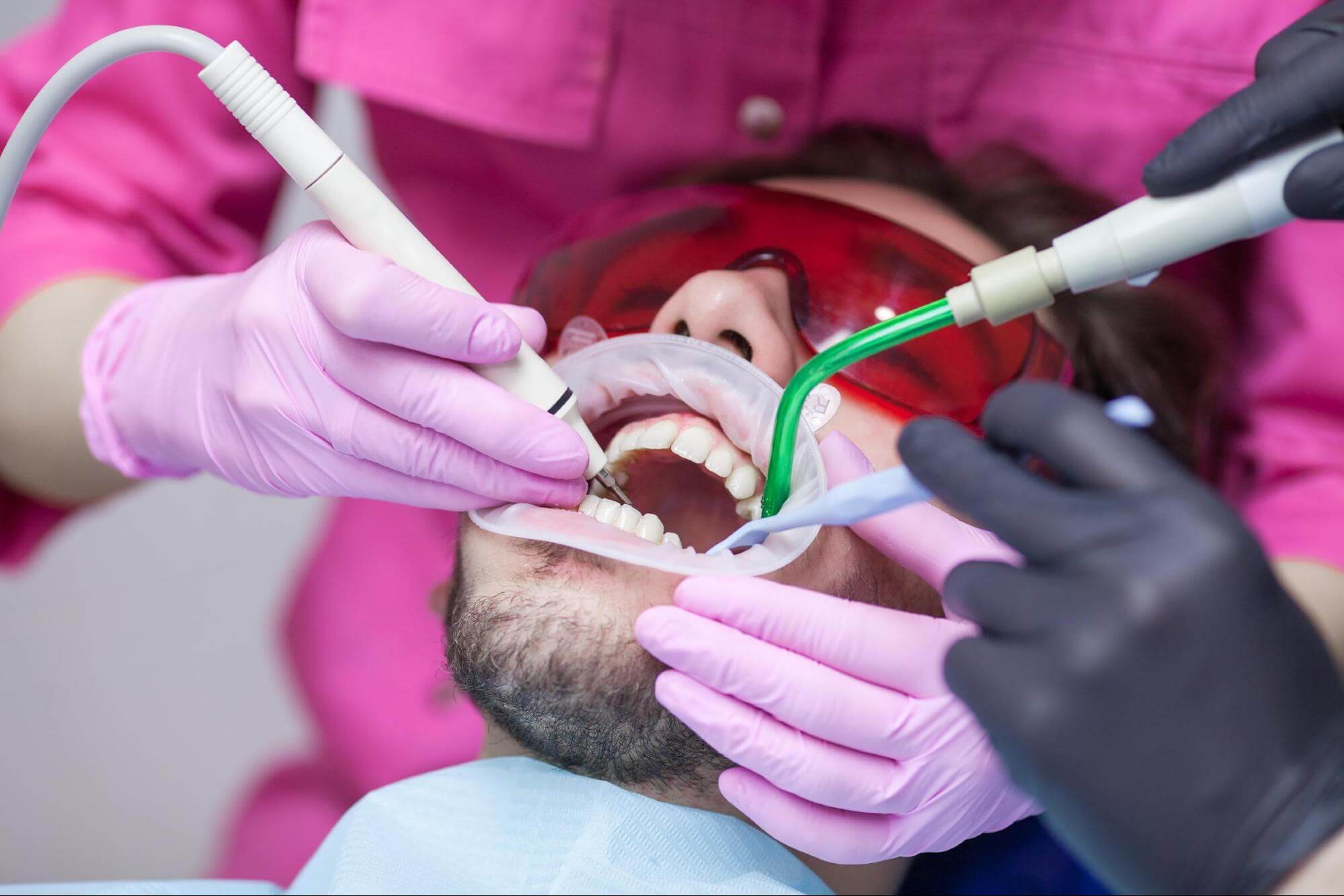 how-much-does-a-root-canal-cost-somos-dental-mesa